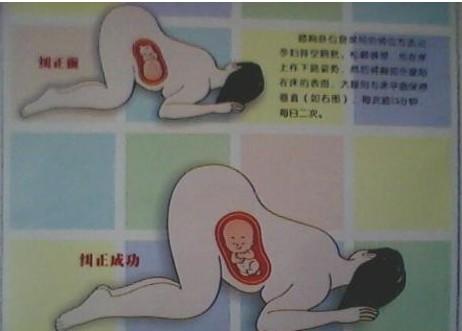 胎位不正的原因 胎位不正的纠正方法及时间