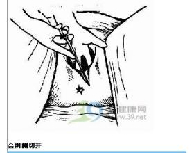 妈妈大谈顺产侧切缝伤口（图）