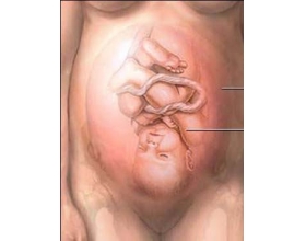 剖腹产分娩过程 剖腹产的术全过程（图片）