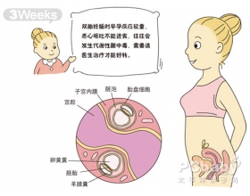 怀双胞胎的症状 双胞胎胎儿发育全过程（图片）