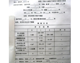 胎心监护怎么做？如何看胎心监护检查结果？