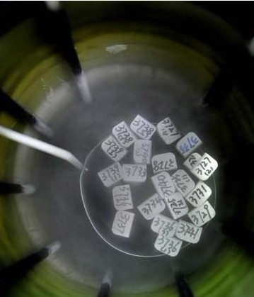 试管婴儿过程 真人实拍试管婴儿全过程（图片）