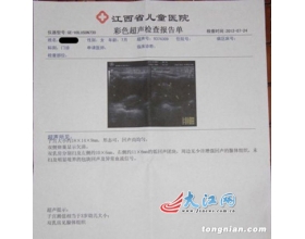 女婴吃美素奶粉致性早熟 厂方施压不要曝光