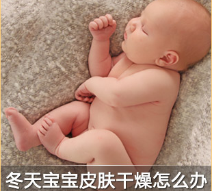 宝宝皮肤干燥怎么办？四招选对宝宝护肤品